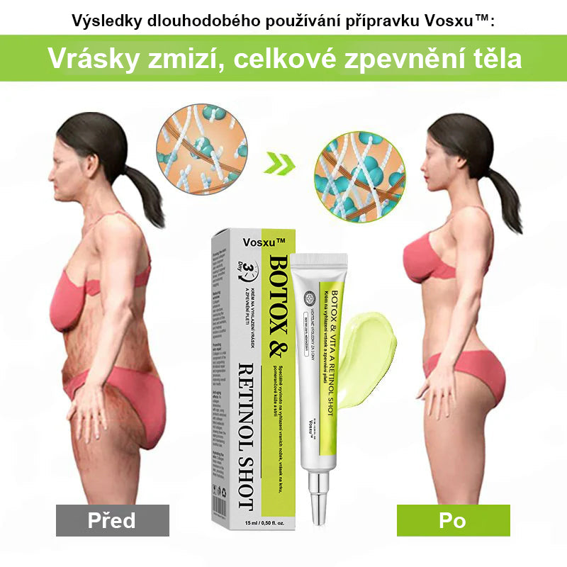 ✨ Vosxu™ Botox & Vita-A Retinol Shot sérum pro lifting vrásek ✨ – 💉 Mikrojehličky | 💪 Peptidy s účinkem botoxu | 🌿 Retinol | ⚡ Viditelné výsledky během 3 dnů 🌸