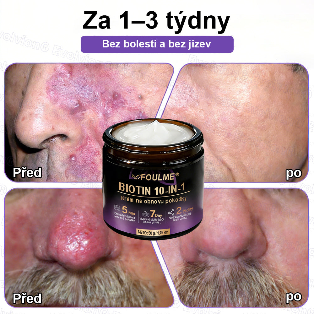 FOULME® Biotin 10-v-1 krém na obnovu pokožky ✨ – hydratační, anti-aging a regenerační péče o pleť 🧴 (kolagen 💧 + kyselina hyaluronová + rostlinné extrakty 🌿)