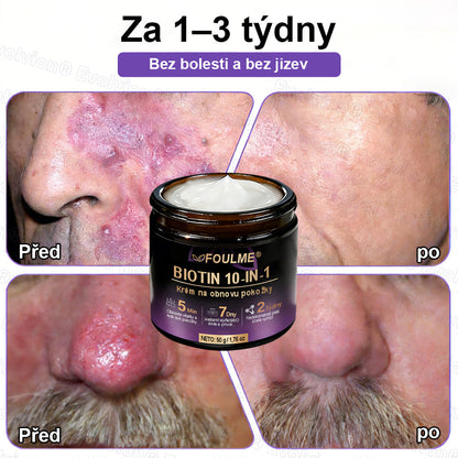 FOULME® Biotin 10-v-1 krém na obnovu pokožky ✨ – hydratační, anti-aging a regenerační péče o pleť 🧴 (kolagen 💧 + kyselina hyaluronová + rostlinné extrakty 🌿)