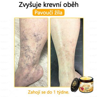 🐝Twisma® Krém s včelím jedem – doporučeno kožními lékaři 🧑‍⚕️ Na různé kožní problémy – fakt účinný a šetrný pomocník
