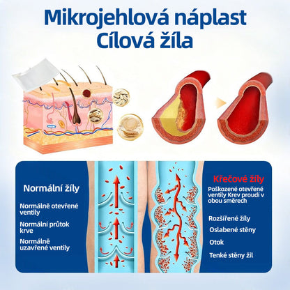 𝑯𝒆𝒂𝒍𝒓𝒊𝒛𝒆® 𝑽𝒆𝒊𝒏𝑻𝒂𝒓𝒈𝒆𝒕 𝒎𝒊𝒌𝒓𝒐𝒋𝒊𝒉𝒍𝒐𝒗á 𝒏á𝒑𝒍𝒂𝒔ť 🌸 96 % klinicky prokázaná účinnost ⚡ Viditelné výsledky už za 7–14 dní 🌿 Šetrná podpora pro lehčí a uvolněnější nohy🌙