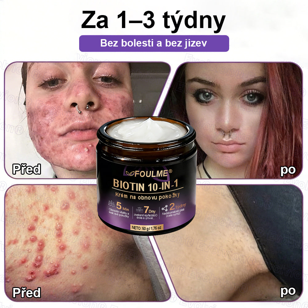 FOULME® Biotin 10-v-1 krém na obnovu pokožky ✨ – hydratační, anti-aging a regenerační péče o pleť 🧴 (kolagen 💧 + kyselina hyaluronová + rostlinné extrakty 🌿)