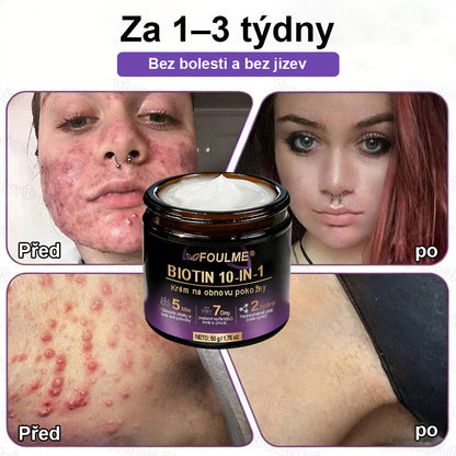FOULME® Biotin 10-v-1 krém na obnovu pokožky ✨ – hydratační, anti-aging a regenerační péče o pleť 🧴 (kolagen 💧 + kyselina hyaluronová + rostlinné extrakty 🌿)