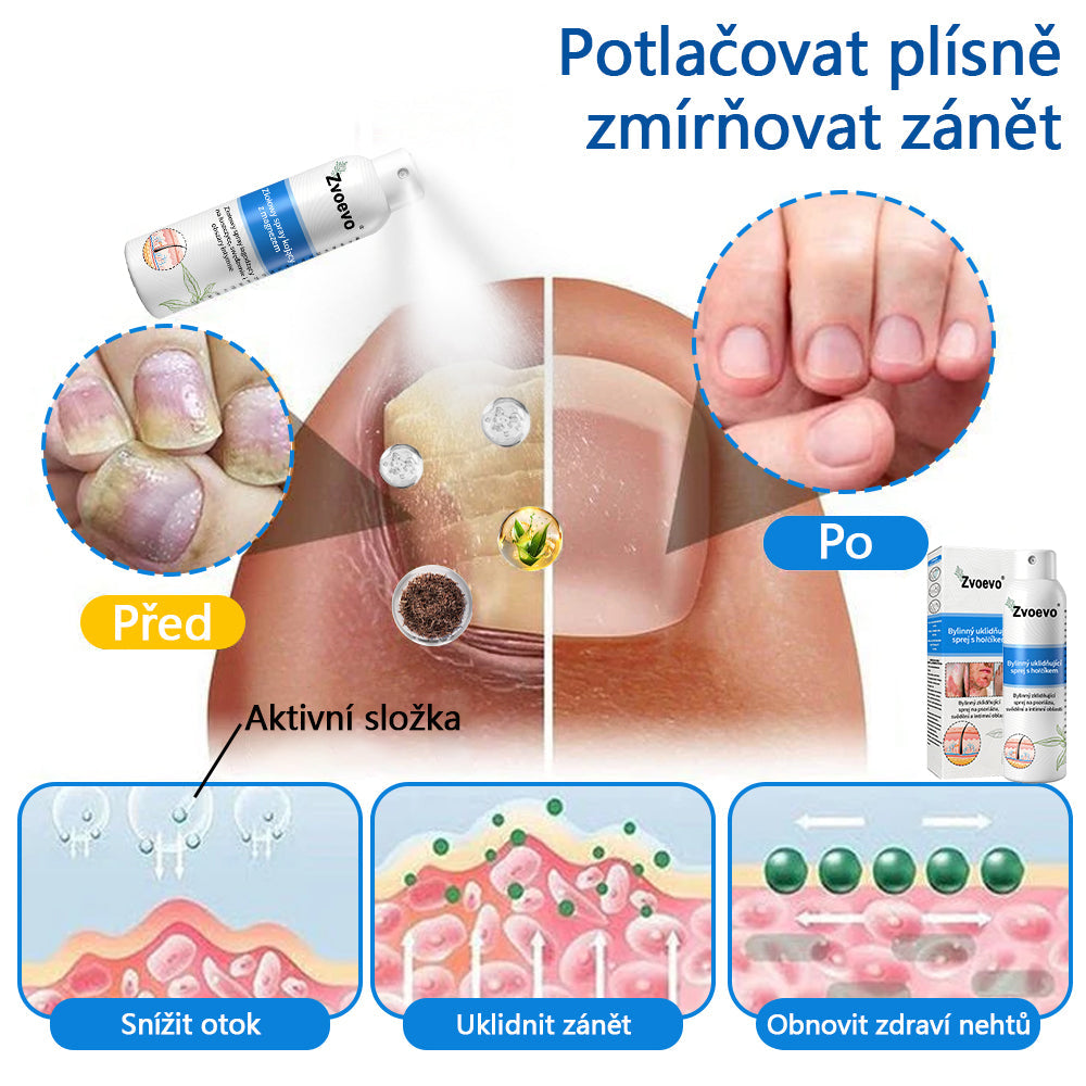 💪 Oficiální obchod: Twisma® Magnesium bylinný sprej na lupénku ✅ CE certifikace (zmírňuje lupénku a ekzém, léčí akné a bradavice, podporuje hojení bakteriálních infekcí, snižuje kloubní a neuropatickou bolest)