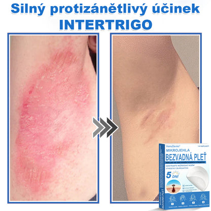 VeruDerm® 2v1 mikrojehličková a hydrokoloidní náplast | Cílená péče o kožní výrůstky, pupínky, ploché bradavice a drobné nedokonalosti ✅ | Pomáhá zjemnit vzhled vrásek, jizev a nerovností pleti ✨ | Diskrétní náplast na obličej i tělo | 144 ks